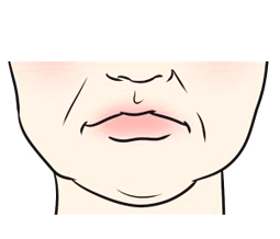 たるみの知識